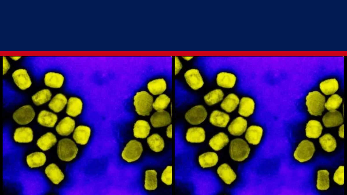 Testy PCR nie mogą diagnozować infekcji mpox