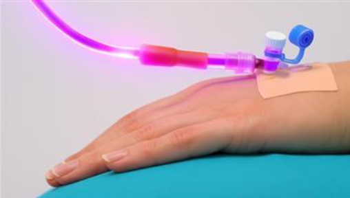 Jak wprowadzenie promieniowania UV do krwi leczy wszystko, od infekcji po choroby serca