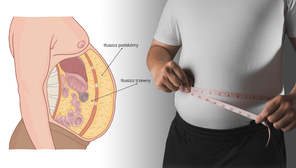 Kwestia kształtu? Zrozumienie i przeciwdziałanie insulinooporności