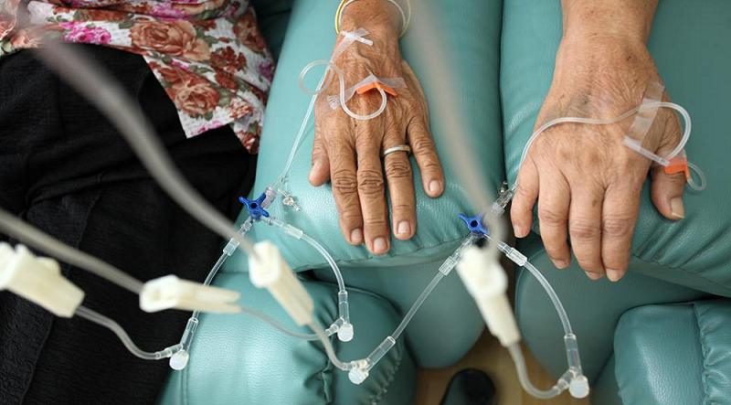 Odtajnione akta CIA ujawniają radzieckie badania z czasów zimnej wojny, łączące pasożyty z leczeniem nowotworów