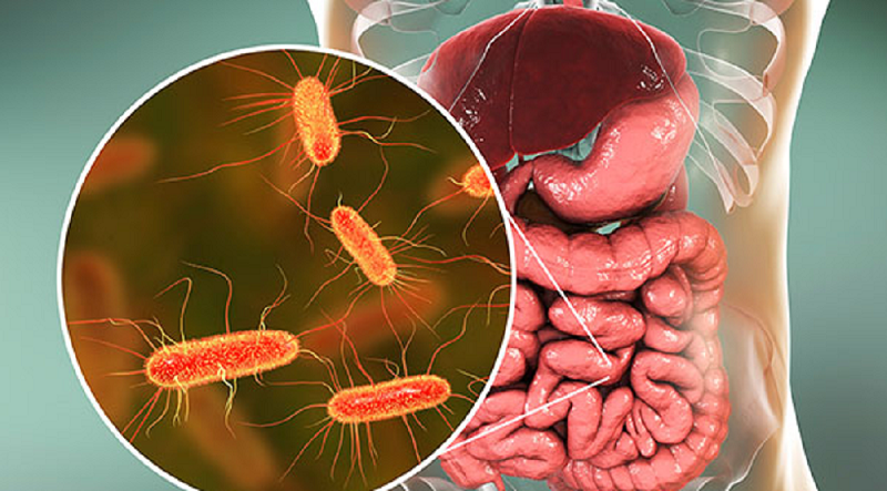 Najgorsi wrogowie Twojego jelita: 5 produktów, które niszczą Twoją mikroflorę jelitową