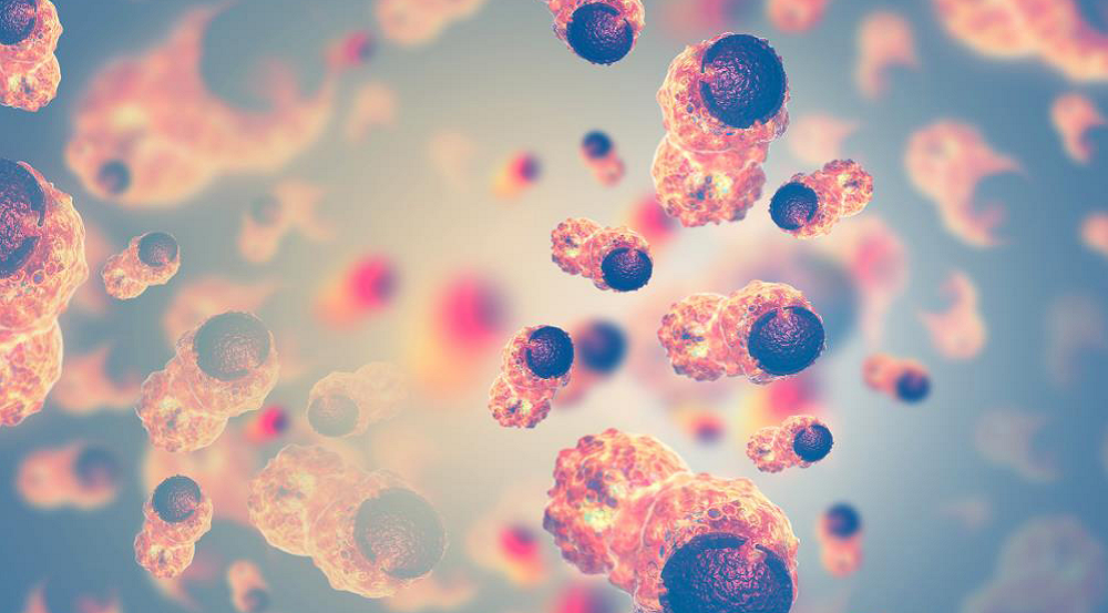 Dlaczego rozwija się rak: 5 procesów, na które można wpływać poprzez dietę, stres i toksyny