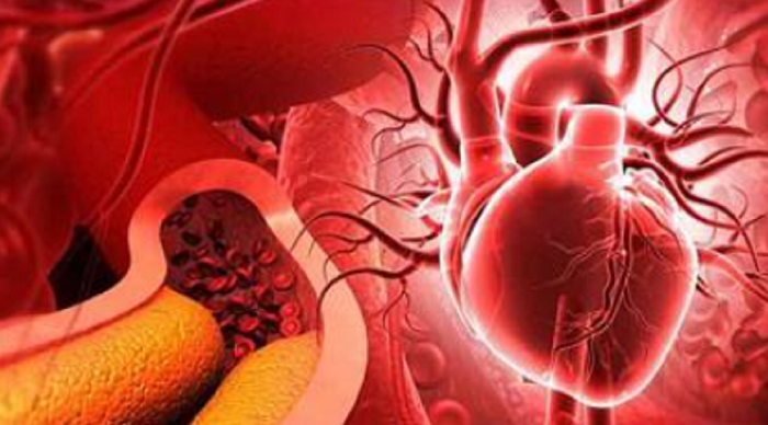 Statyny, cholesterol i prawdziwa przyczyna chorób serca