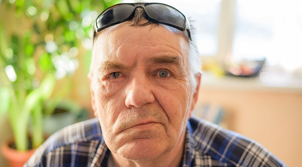 Z czego wynika nagły wzrost liczby przypadków porażenia Bella?